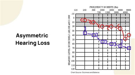 How to Interpret an Audiogram From a Hearing Test .